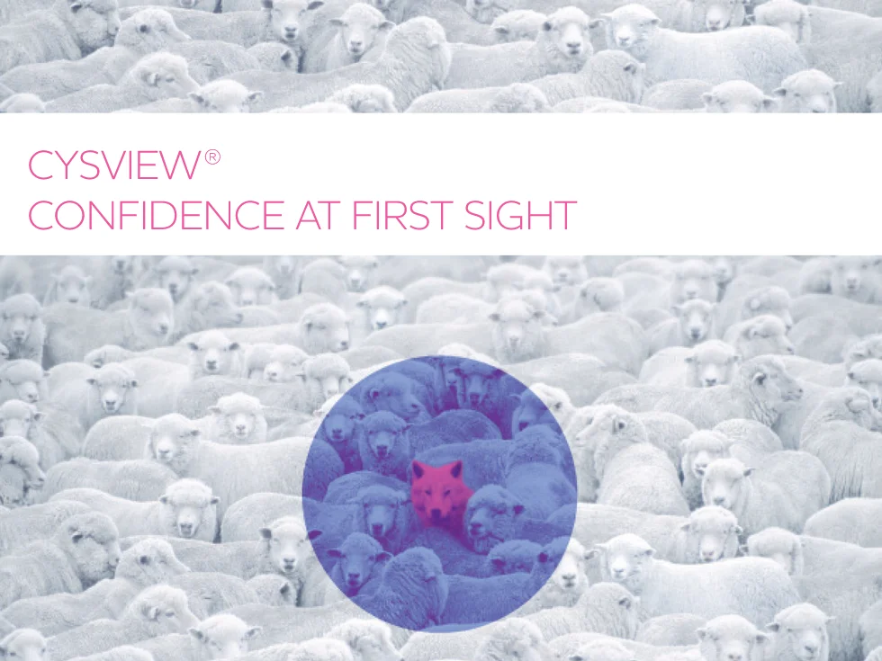 BioSyent Cysview IQVIA OCE CLM title slide, Confidence at First Sight
